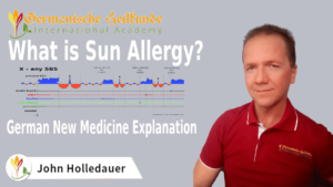 Sun Allergy